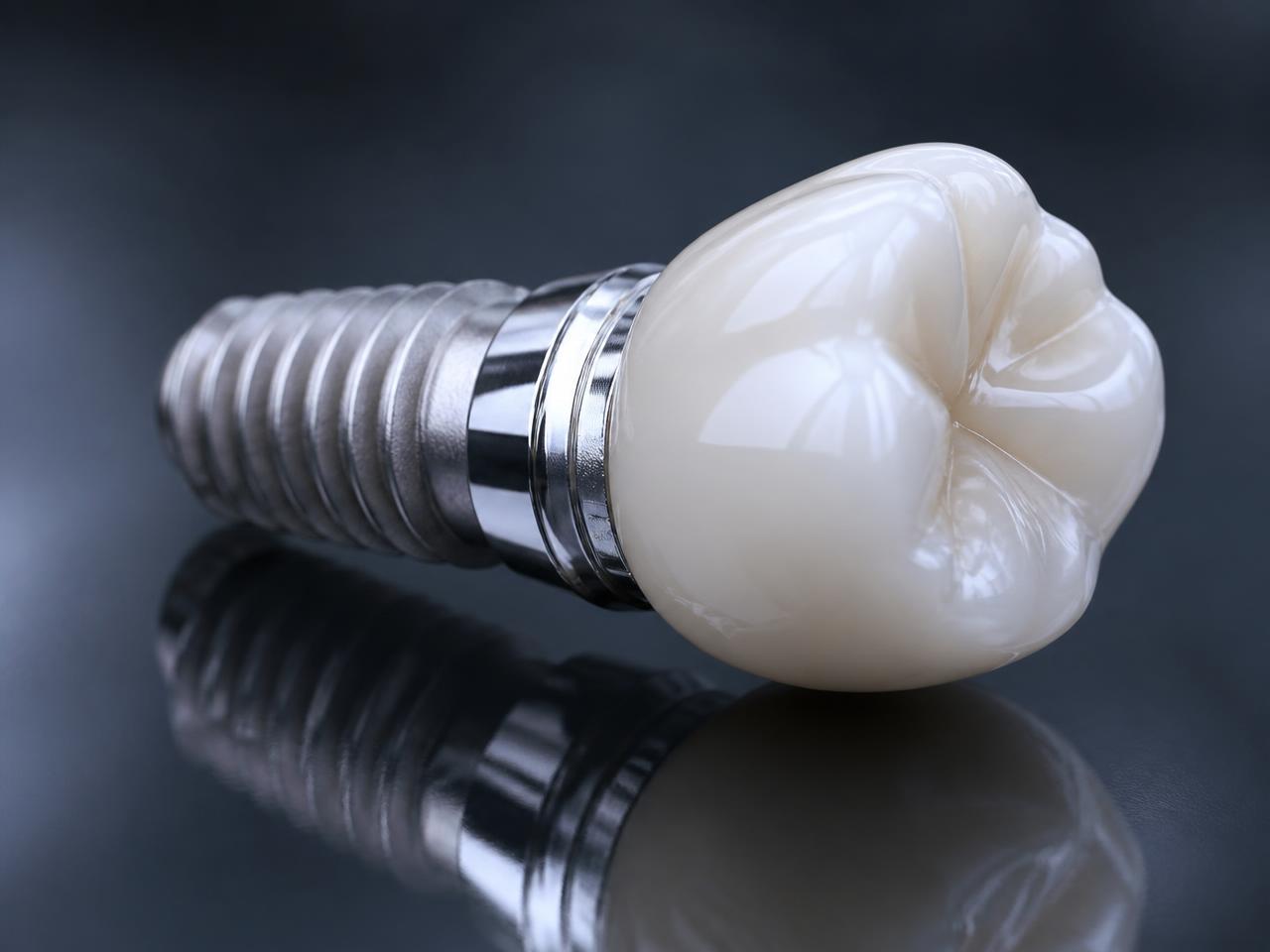 Dental implant with a ceramic crown affixed